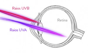 Ilustração de um olho com a incidência de raios UVA e UVB. Os raios UVA estão em cor roxa e os, UVB em cor vermelha. Os raios UVA incidem diretamente no fundo da retina., enquanto os raios UVB  incidem na córnea e no cristalino.