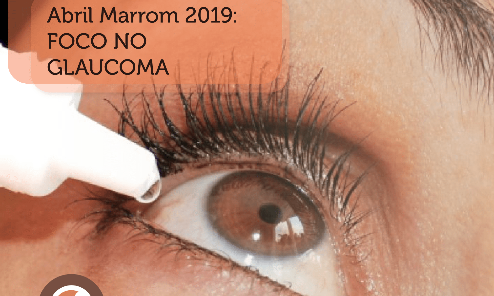 #PraCegoVer imagem de um olho castanho bem aproximada. A imagem mostra uma gota de colírio sendo pingada no olho. Está escrito: "Abril Marrom 2019: FOCO NO GLAUCOMA" há também #abrilmarrom no parte superior e na parte inferior há a Faixa da Campanha, a Logo da Retina Brasil e a logo da Bayer