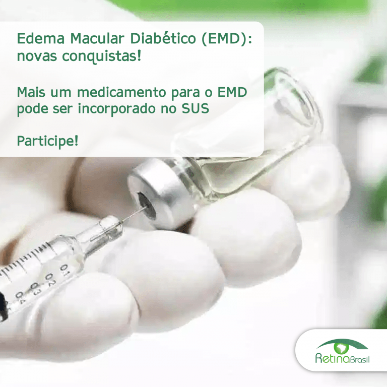 #PraCegoVer imagem ilustrativa de uma mão manipulando uma injeção. Está escrito: " Edema Macular Diabético (EMD): novas conquistas! Mais um medicamento para o EMD pode ser incorporado no SUS Participe!" No canto inferior direito está a logo da Retina Brasil.