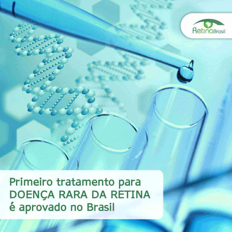 #descricaodaimagem: imagem ilustrativa. A imagem mostra tubos de ensaio representativo e atrá há a representação de um filamento de DNA. Está escrito: "Primeiro tratamento para doença rara da retina é aprovado no Brasil" e há a logo da Retina Brasil.