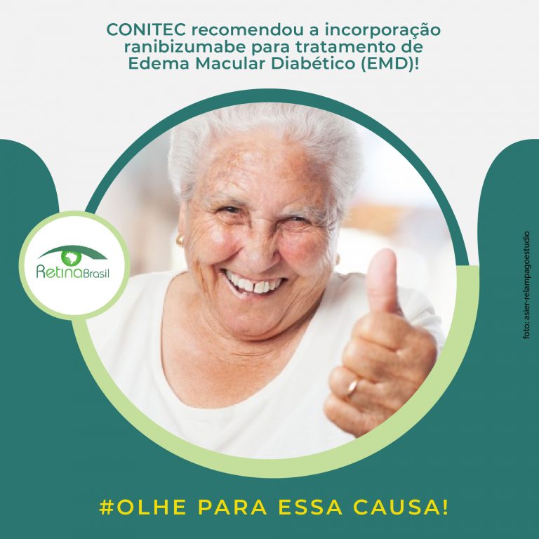 #descricaodaimagem. A imagem mostr a foto de uma senhora sorrindo com um dos braços estendido para frente. Está escrito: "Conitec recomendou a incorporação do ranibizumabe para tratamento de Edema Macular Diabético (EMD)" #olheparaessacausa. Há ainda a logo da Retina Brasil.