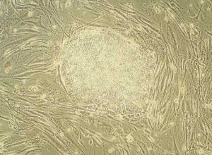 Células-tronco embrionárias humanas crescendo em uma placa de petri.Essas células podem se desenvolver em cada um dos 200 tipos diferentes de células do corpo humano.