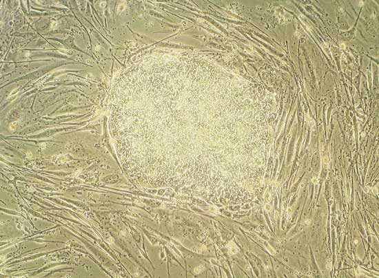 Células-tronco embrionárias humanas crescendo em uma placa de petri.Essas células podem se desenvolver em cada um dos 200 tipos diferentes de células do corpo humano.