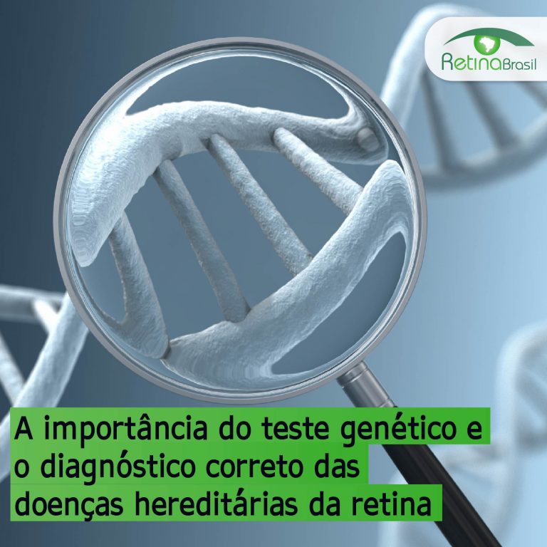 imagem da representação de um filamento de DNA com uma lupa por cima. Está escrito: "A importância do teste genético e o diagnóstico correto das doenças hereditárias da retina" e há a logo da Retina Brasil