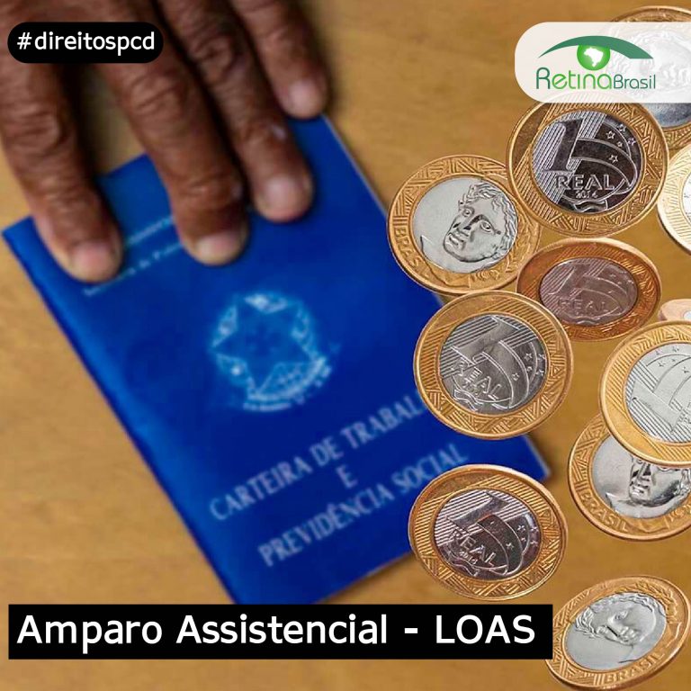 imagem de uma mão com uma carteira de trabalho e moedas ao lado. Está escrito: "Amparo Assistencial - LOAS" #direitospcd e há a logo da Retina Brasil