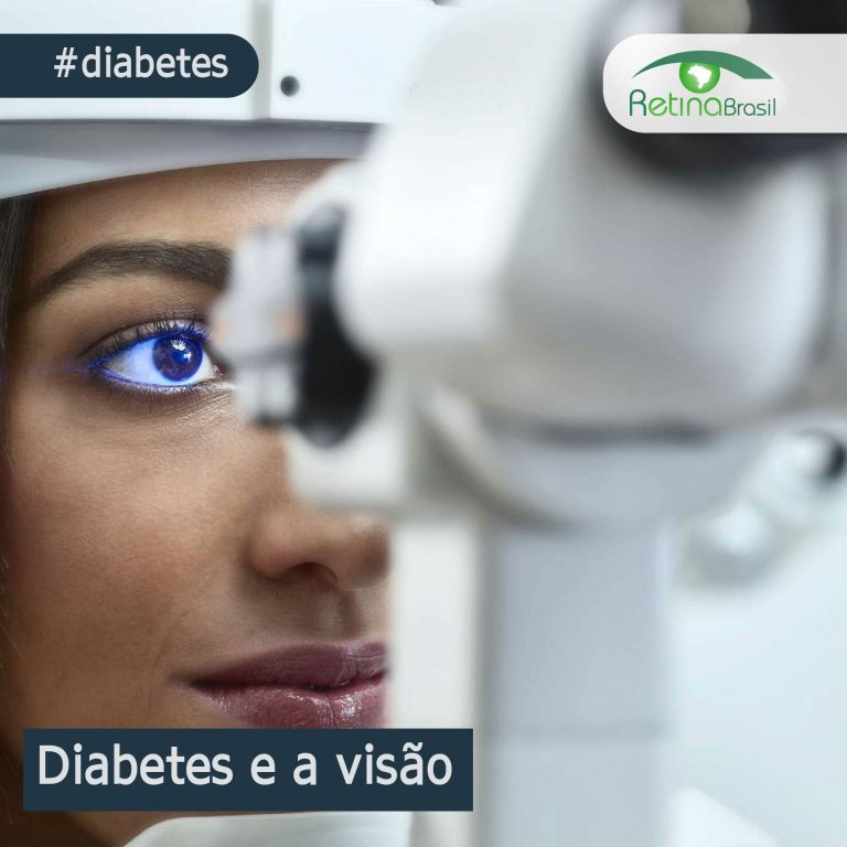 imagem de uma mulher fazendo exame oftalmológico. Está escrito: "Diabetes e a visão" #diabetes e há a logo da Retina Brasil